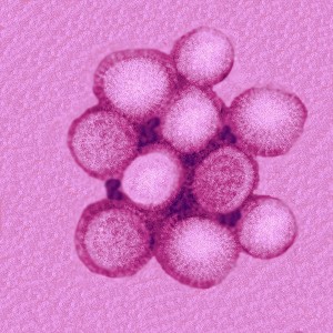 AH1N1-virus